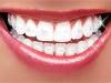 یک فرد به طور معمول بسته به سن باید چند دندان داشته باشد؟
