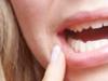 Co dělat, když vás bolí dásně?