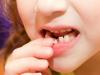 अगर किसी बच्चे का दूध का दांत नहीं गिरा है लेकिन दाढ़ का दांत बढ़ रहा है तो क्या करें