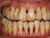 Bau mulut kronis, penyebab dan solusinya