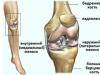 إصابات الغضروف المفصلي لمفصل الركبة: العلاج بدون جراحة في المنزل ومجموعات المخاطر وأنواع الضرر ما هي أعراض الغضروف المفصلي لمفصل الركبة