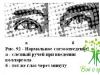 Study of the patency of the lacrimal ducts, canalicular test