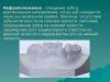 Значението на думата антагонистични зъби в медицински термини