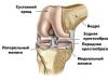 Pecahnya tanduk posterior meniskus medial sendi lutut - pengobatan, gejala, analisis lengkap cedera
