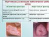 Левкоплакия на шийката на матката: традиционна медицина срещу народни средства