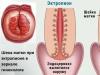 Умайн хүзүүний элэгдэл ба эктропион гэж юу вэ, ялгаа нь юу вэ, яагаад аюултай вэ?