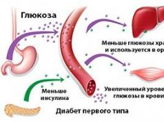 Diabetes mellitus no dependiente de insulina: los conceptos básicos de la patogénesis y la terapia